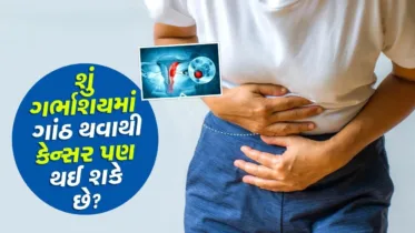 ગર્ભાશયમાં ગાંઠ થવાથી કેન્સર થઈ શકે છે? ગાયનેકોલોજીસ્ટ પાસેથી જાણો